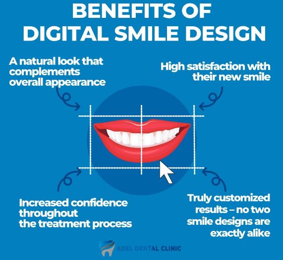 benefits of digital smiledesign